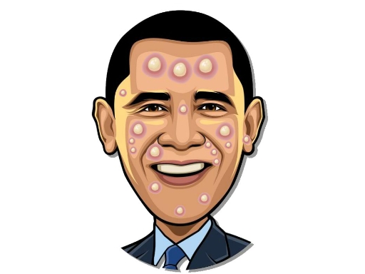 Celebrity Pimple Pop img